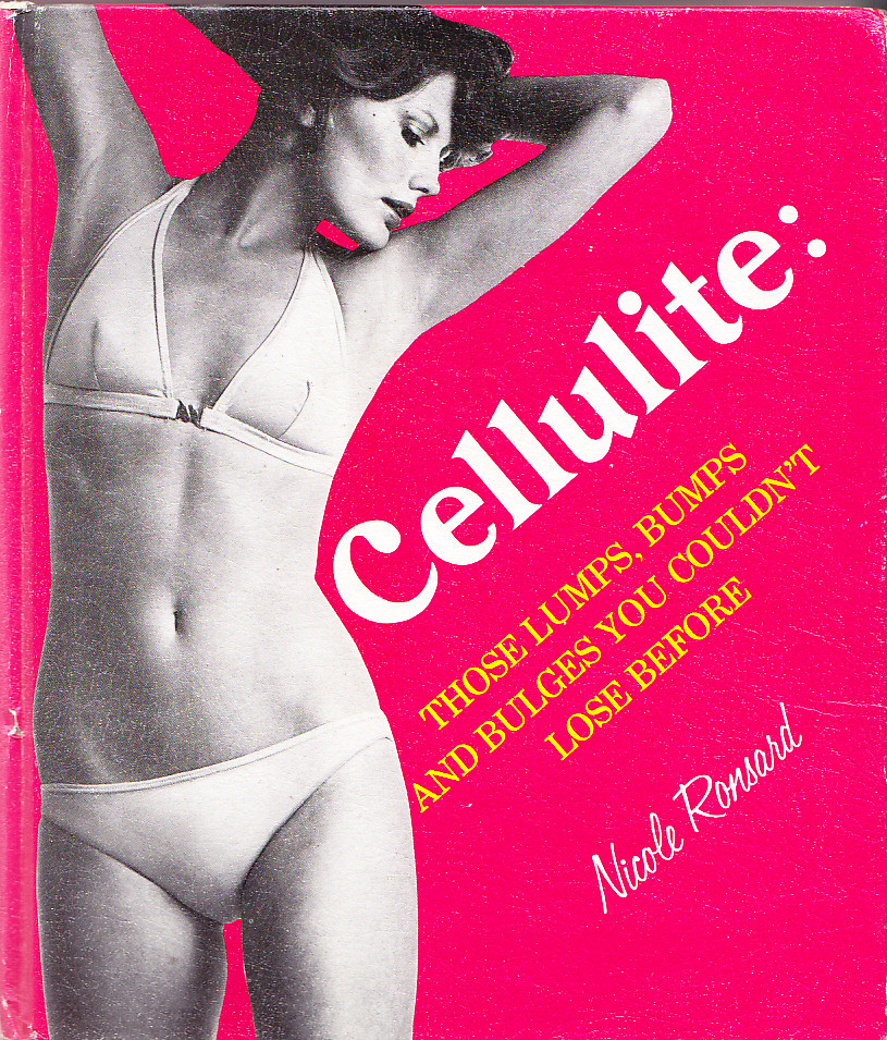 Does Cryotherapy Help With Cellulite?